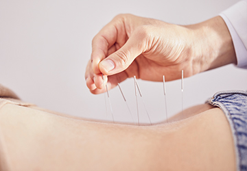 약침봉침주사이미지